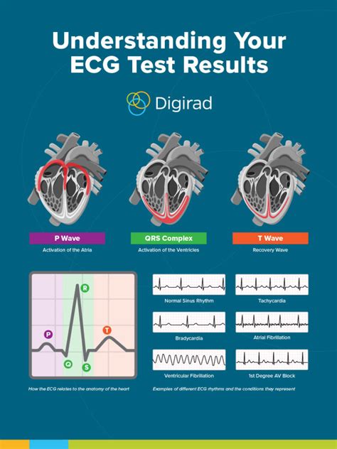 ecg result validity period philippines|Medical Education .
